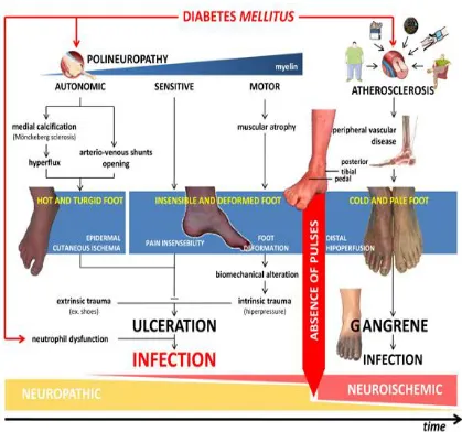 Fig.1 Pathways to foot ulceration in diabetic patients