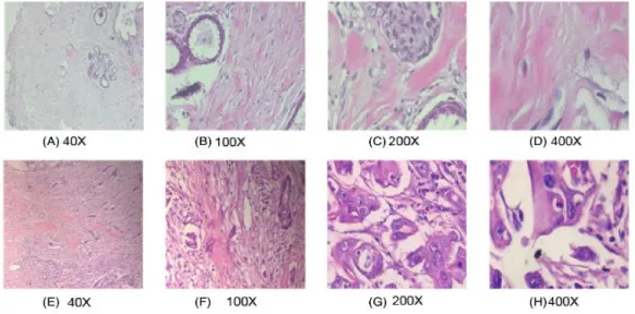 Figure 4.5   BreaKHis Dataset for Histopathological Images  