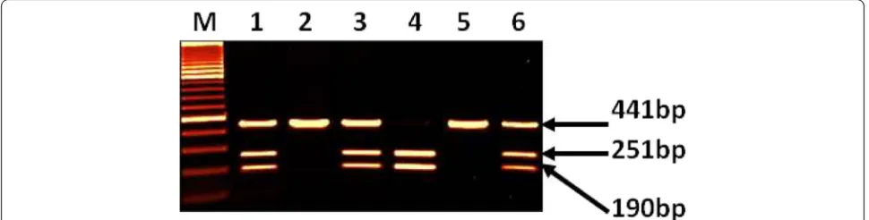 Fig. 2 Amplified DNA digested with SfaNI showing genotypes of IL-6(174G/C). Lane M: 100 bp DNA marker, Lane 1, 2, 3,5,6,7 and 8 for genotypeGC (3 bands of 198, 140 and 58 bp), Lane 4 for genotype CC (uncut DNA of 198 bp), Lane 10 for genotype GG (2 bands of 140 and 58 bp)