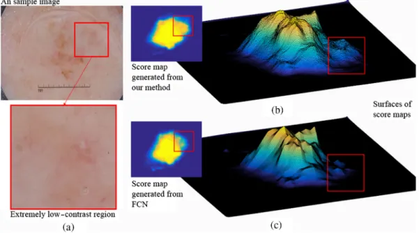 Fig. 3 The effects of fusing feature maps derived from two networks: (a) a sample image with extremely low contrast, particularly in the local region shown in zoomed in box, top image in (b) shows the integrated score map generated from our network with it