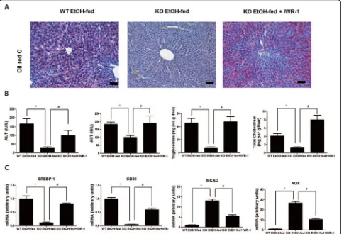 Fig. 7 Effects ofnand MCAD) in the livers of ethanol-fed WT mice, ethanol-fed parkin KO mice, and ethanol-fed parkin KO mice injected with IWR-1 (25parkin KO mice injected with IWR-1 (2550 β-catenin signaling inhibitor on hepatic lipid accumulation in etha