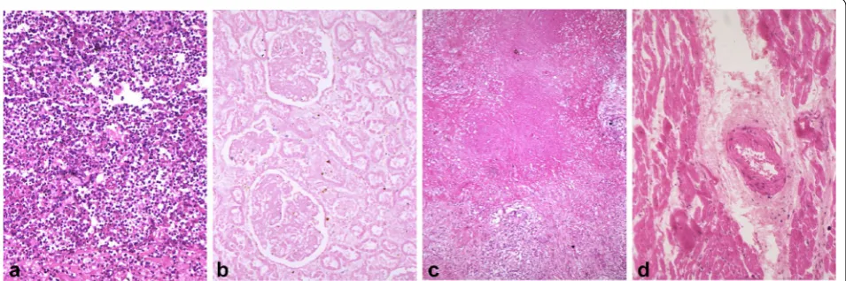 Fig. 2 Several common necrosis types in human tissues. a An area of liquefactive or lytic necrosis from a lung abscess, which is fraught with inflammatory cells