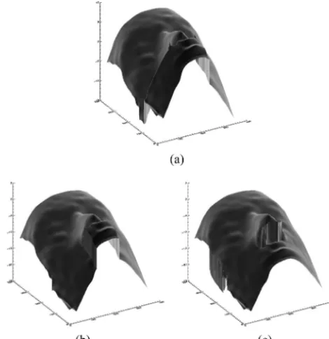 Fig. 11.Three different frames of fringe patterns for a patientundergoing radiotherapy treatment for breast cancer
