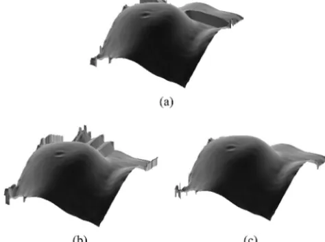 Fig. 13.Three-dimensional view for the unwrapped-phase mapsfor frame 24, showing a clinical patient’s breast using the (a)Cusack algorithm, (b) Huntley algorithm, and (c) proposed algo-rithm.
