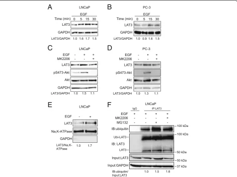 Fig. 6 EGF treatment increases LAT3 expression on the plasma membrane.presence of EGF in LNCaP cells by cell surface protein isolation; Na, K-ATPase was used as loading control