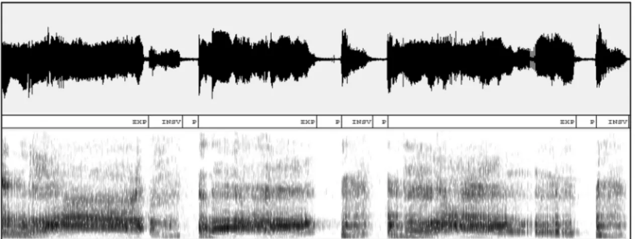 FIGURE 1. An example of a portion of cry signal with its corresponding components expiration (EXP), audible inspiration (INSV), and pauses (P).