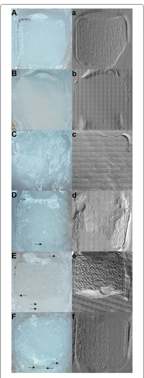 Figure 3 Representative microscopic and SEM images ofmedian ARI scores. A-F: 10× magnification; arrows mark detectedsilver spots