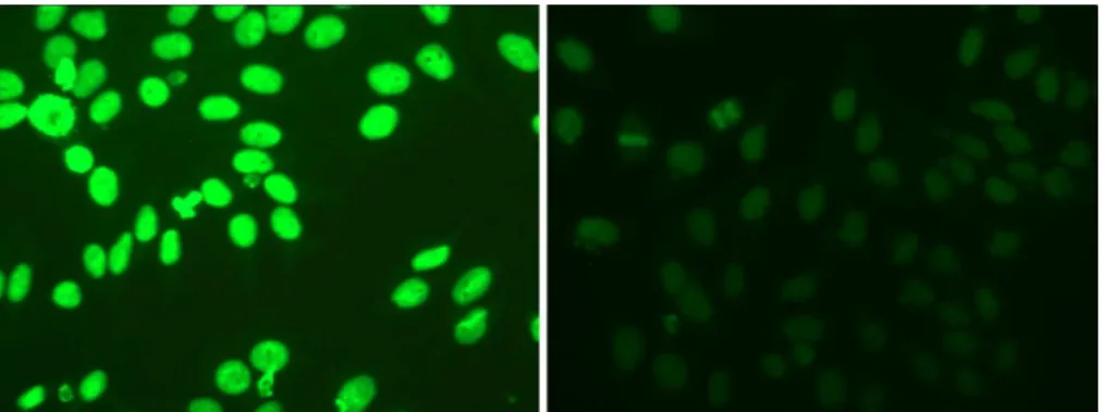 Figure 1: HEp-2 IIF images with positive (left) and intermediate (right) fluorescence intensity.