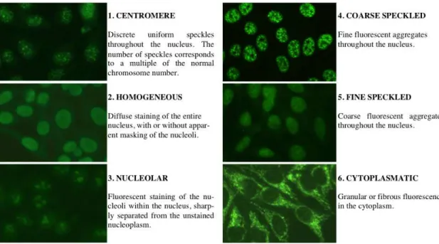 Figure 2: HEp-2 staining patterns that are considered relevant to diagnostic pur- pur-poses.