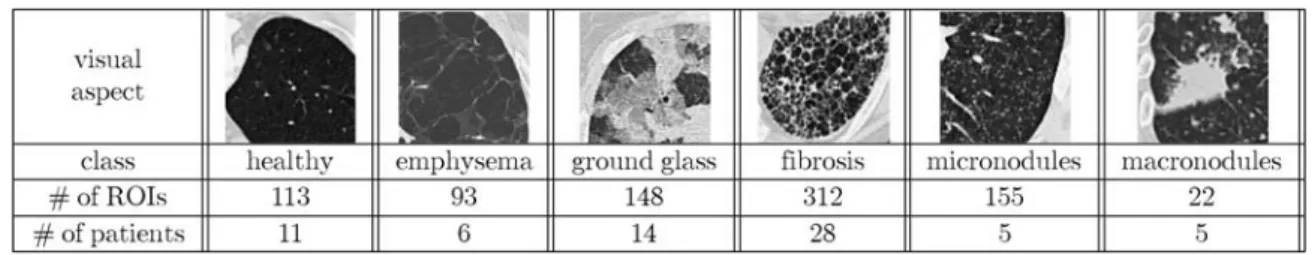 Table 1. Distribution of the ROIs Per Class of Lung Tissue Pattern