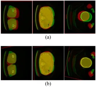 Fig. 2.3 Illustrates the results obtained by registering the 3 selected slices (using, in this  case, the first, the middle, and last slices) in the first part of the registration process