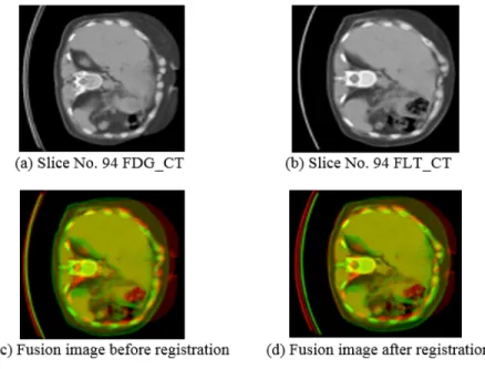 Fig. 3.10 Registration results of slice No.95 FDG_CT and FLT_CT image 