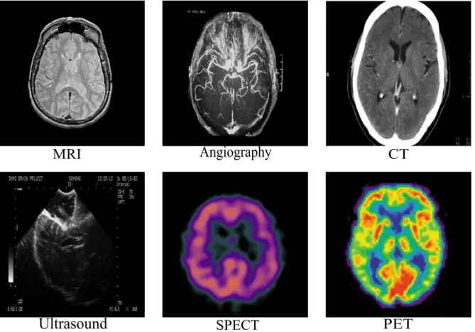 Figure 1.2: Multi-modal brain Images