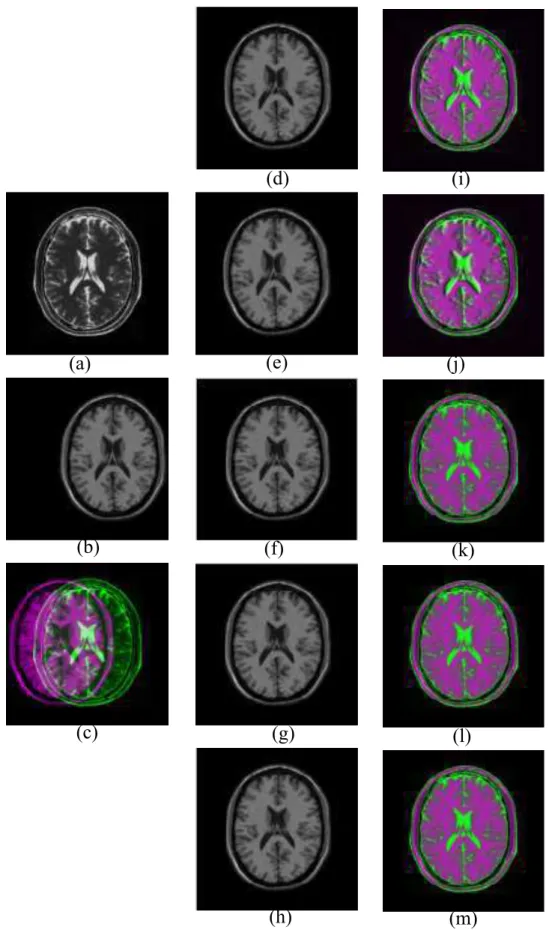 Figure 2.4: (a) Reference image, (b) Floating image translated along x axis, (c) Paired image before registration, (d-h) Registered image and (i-m) Paired image after registration using NMI (Viola), SMI (Pluim), RMI (Russako), QMI (Luan) and EMI (proposed