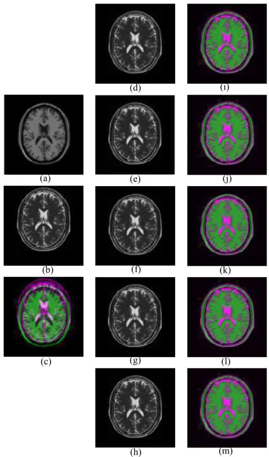 Figure 2.5: (a) Reference image, (b) Floating image translated along y axis, (c) Paired image before registration, (d-h) Registered image and (i-m) Paired image after registration using NMI (Viola), SMI (Pluim), RMI (Russako), QMI (Luan) and EMI (proposed