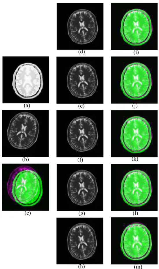Figure 2.7: (a) Reference image, (b) Floating image translated and rotated about x axis, (c) Paired image before registration, (d-h) Registered image and (i-m) Paired image after registration using NMI (Viola), SMI (Pluim), RMI (Russako), QMI (Luan) and E