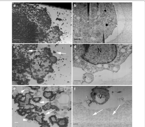 Fig. 6 Differences in the ultrastructure between BMSC cultured in osteogenic (filled with electron-heavy hydroxyapatite crystals (a, c, e) and non-osteogenic (b, d, f) conditions, revealed by FIB milling and observed with SEM as block-face low voltage imag