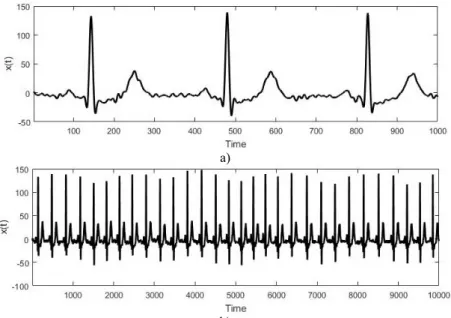 Fig. 1. a) Short electrocardiogram signal, b) full electrocardiogram data  3. Methods 
