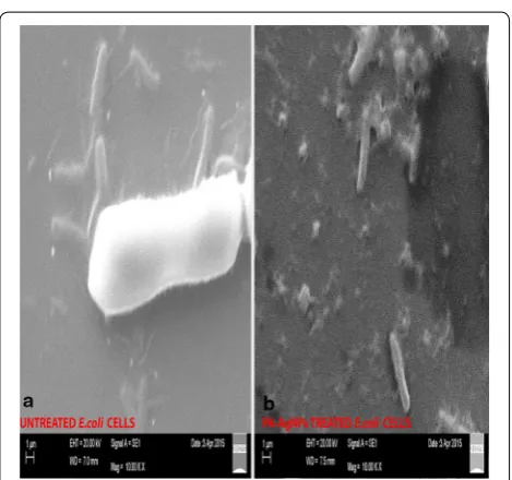 Fig. 10 Antibacterial activity of PA-AgNPs against gram negative bacteria (E. coli). Test (T1—10 µg/ml; T2—20 µg/ml; STD—15 µg/ml)