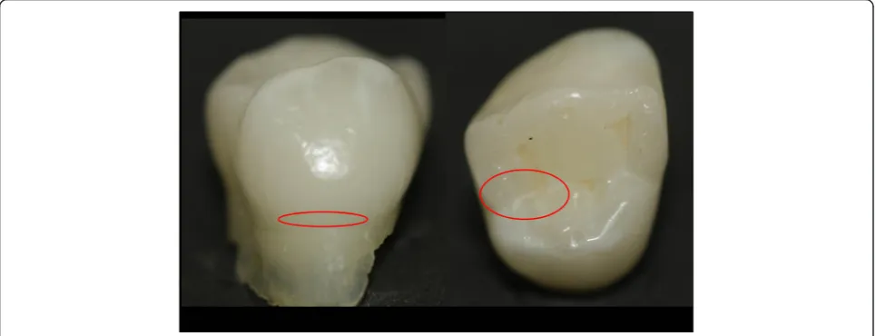 Fig. 1 Schematic representation of area selected for ESEM capture
