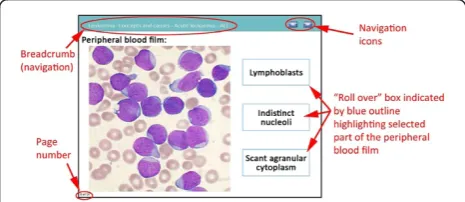Figure 2 Annotated screenshot of an interactive questionscreen in the leukaemia module.
