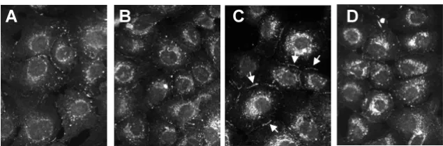 Figure 1Effect of oxysterols on subcellular distribution of Cx43Effect of oxysterols on subcellular distribution of Cx43