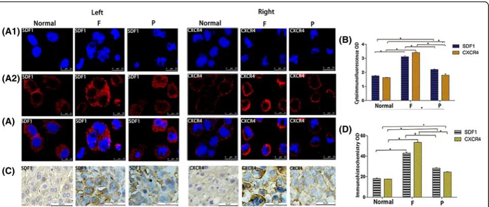 Fig. 4 Expression of SDF1 and CXCR4 in different hepatocarcinoma cells and normal liver cells in vitro and in vivo.Cytoimmunofluorescence cellnuclear DAPI staining (A1), cell staining (A2), merged picture(A) and immunohistochemistry (C)] analysis of SDF1 (
