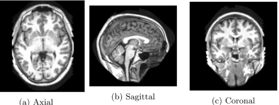 Figure 2.1: Three different views from MR images.