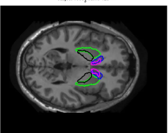 Figure 2.2: The four basal ganglia main structures manually segmented.: Cau- Cau-date, Putamen, Pallidum, Accumbens