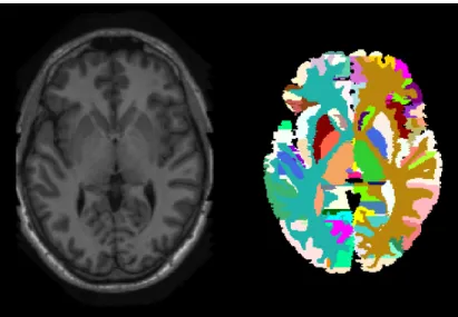 Figure 2.3: On the left side we show an MR image and on the right side the corresponding labelled atlas [2].