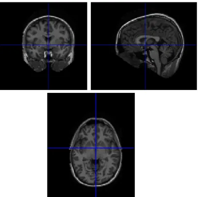 Figure 4.1: Example of resetting coordinates to the origin [2].