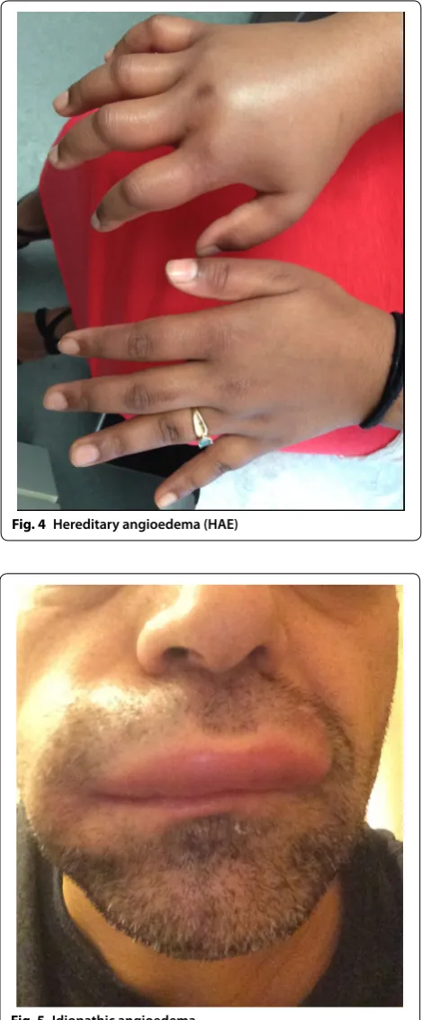 Fig. 4 Hereditary angioedema (HAE) 