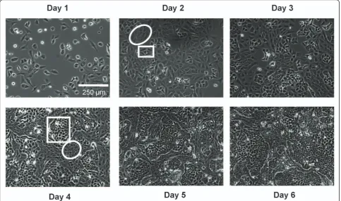 Figure 2 Spatial organization of MCF-7 and MCF-7/Doxo in co-cultures. To obtain phase contrast micrographs of growing MCF-7 variants inco-cultures, dishes were seeded with a 50:50 mixture of MCF-7:MCF-7/Doxo at day 0