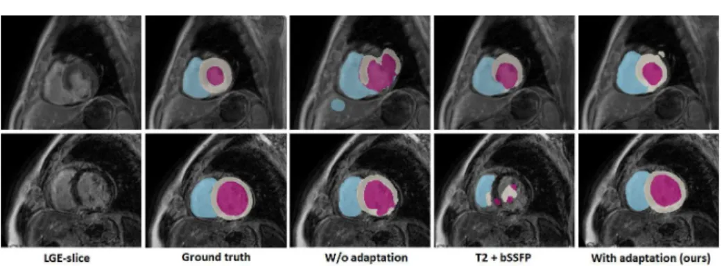 Fig. 3. Visual comparison of segmentation results produced by different methods.