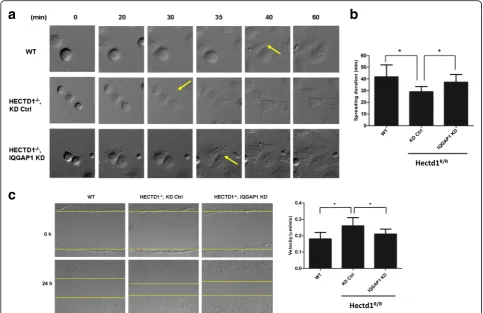 Fig. 9 Knockdown of IQGAP1 rescue the defects of spreading and migration of Hectd1R/R cells