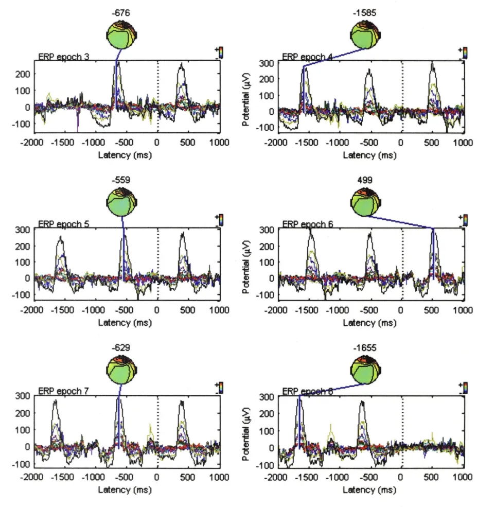 Figure 2.8:  Plotting of ERP data with  scalp maps for Epoch s 