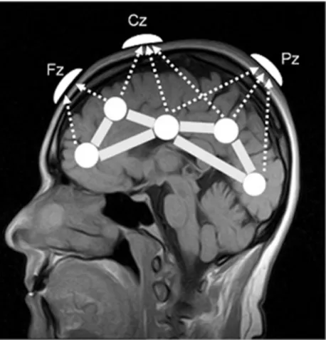 Figure 3.7 : Volume conduction effect in scalp EEG. [119]