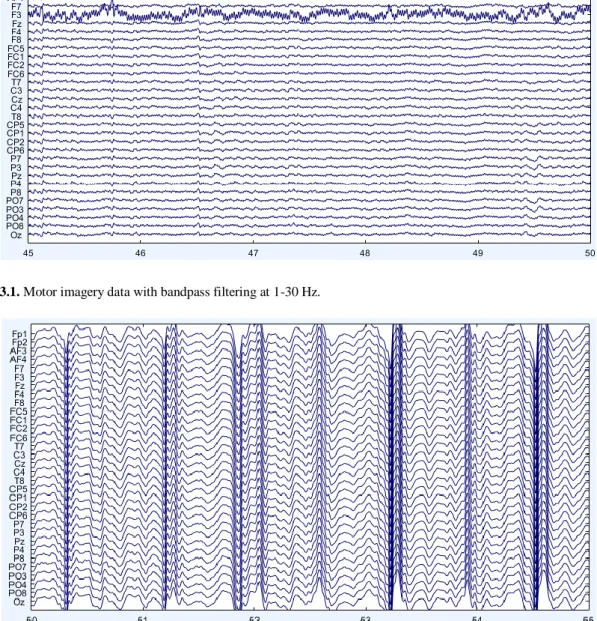 Figure 3.1. Motor imagery data with bandpass filtering at 1-30 Hz. 