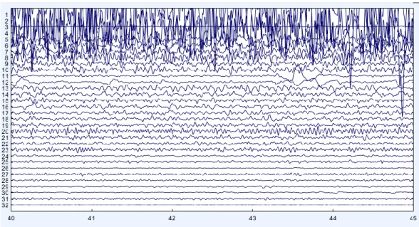 Figure  3.4.  ICA  components  activations.  These  representation  of  components  helps  to  identify  components  pointing  for 
