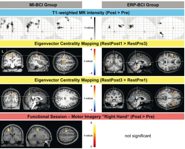 Figure 4. Changes in structural and functional MRI parameters after 1 h of BCI for the MI-BCI and ERP-BCI group, respectively