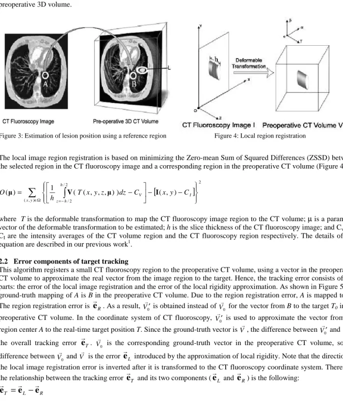 Figure 3: Estimation of lesion position using a reference region  Figure 4: Local region registration 