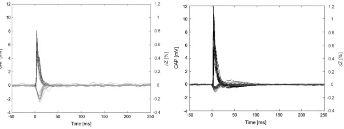 Fig. 4 Examples of compound action potential (positive, black) and associated resistance change (dZ, negative, grey)