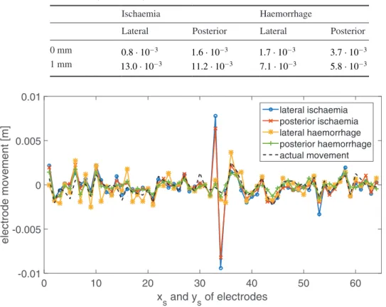Table 1.   2-norm of the difference in simulated and recovered electrode position errors  when electrodes were accurately modelled in the reconstruction algorithm (first row)  and when there was a position mismatch of 1 mm standard deviation along both sur