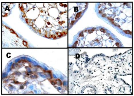 Figure 1with anti-ChAT antibody as previously describedHuman placenta obtained at 23 weeks gestation was stained Human placenta obtained at 23 weeks gestation was stained with anti-ChAT antibody as previously described