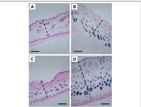 Figure 2 Skin thickness in Nrf2 WT versus Nrf2 KO mice after UVB exposure. H&E staining was performed in skin samples 8 days aftertreatment with a single dose of UVB (300 mJ/cm2)