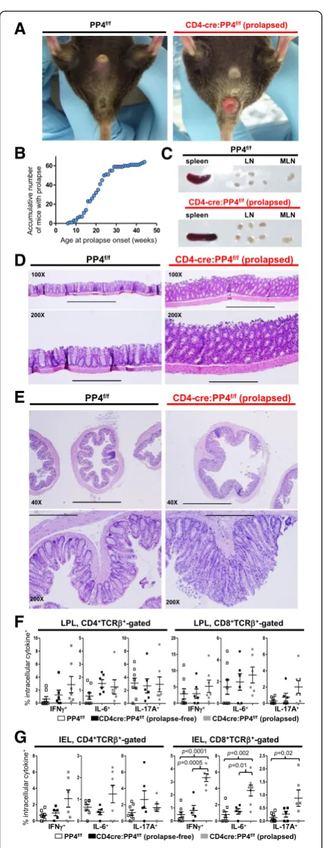 Figure 4 CD4cre:PP4f/f mice develop spontaneous rectalprolapse and colitis with symptoms resembling Crohn’sdisease