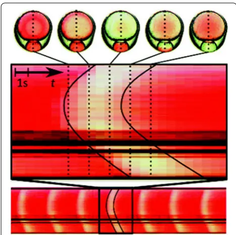Fig. 13 permission from Ref. [a Swollen and dried threads of hydrogel with varying pore size and connectivity, b vertices of interwoven foam threads
