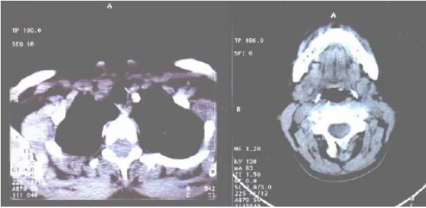 Figure 1.  Two arbitrary CT sections used for the development of computational  phantom