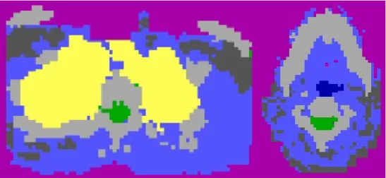 Figure 3.  Two images of final computational phantom – MCNP-5. 