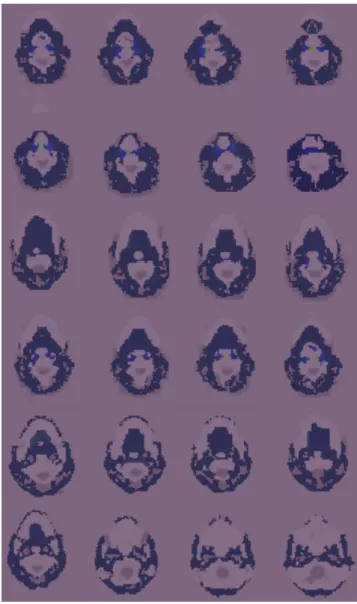 Figure 4 – A set of images from the nasopharyngeal taken from the interface of the  SISCODES, which provides the profile of absorbed dose on the region related to the 